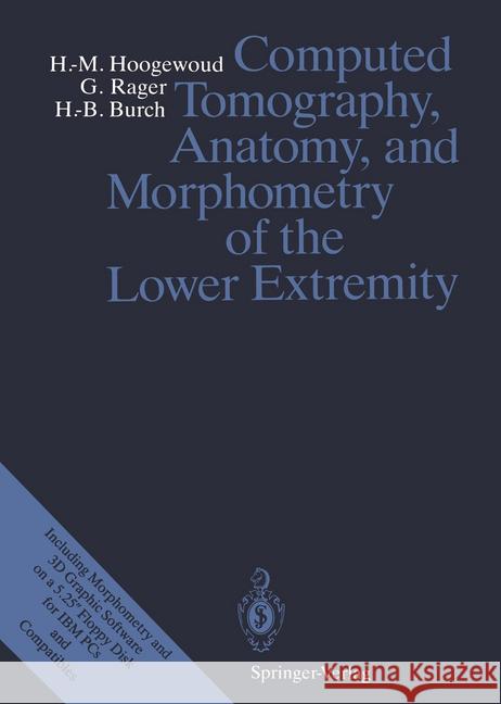 Computed Tomography, Anatomy, and Morphometry of the Lower Extremity Henri-Marcel Hoogewoud G. Nter Rager Hans-Beat Burch 9783642746512 Springer