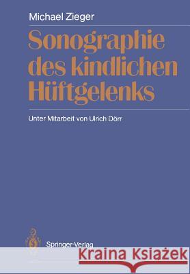 Sonographie Des Kindlichen Hüftgelenks Zieger, Michael 9783642746604 Springer