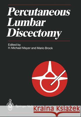 Percutaneous Lumbar Discectomy H. Michael Mayer Mario Brock 9783642746819