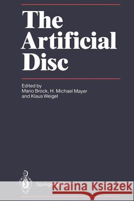 The Artificial Disc Mario Brock H. Michael Mayer Klaus Weigel 9783642751998
