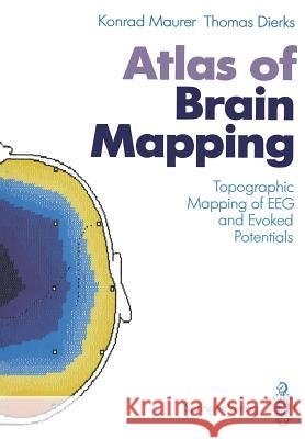 Atlas of Brain Mapping: Topographic Mapping of Eeg and Evoked Potentials Maurer, Konrad 9783642760457 Springer
