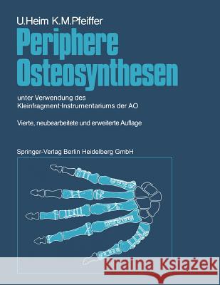 Periphere Osteosynthesen: Unter Verwendung Des Kleinfragment-Instrumentariums Der Ao Oberli, K. 9783642763151 Springer