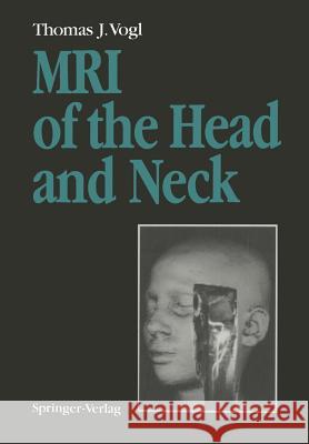 MRI of the Head and Neck: Functional Anatomy -- Clinical Findings -- Pathology -- Imaging Vogl, Thomas J. 9783642767920 Springer