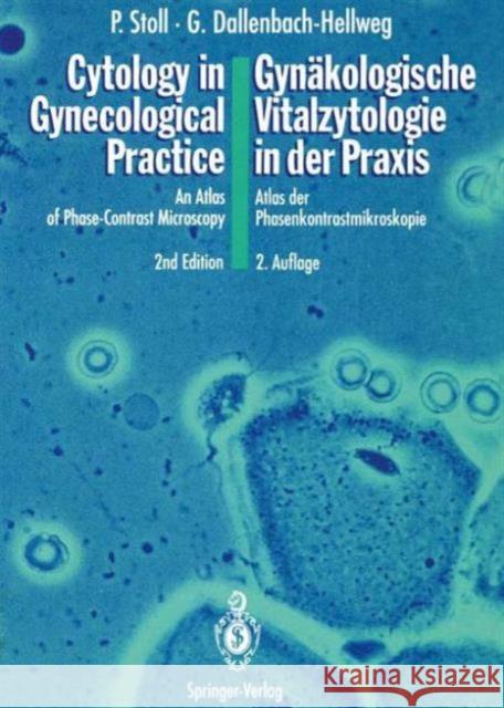 Cytology in Gynecological Practice / Gynäkologische Vitalzytologie in Der Praxis: An Atlas of Phase-Contrast Microscopy / Atlas Der Phasenkontrastmikr Stoll, Peter 9783642769054 Springer