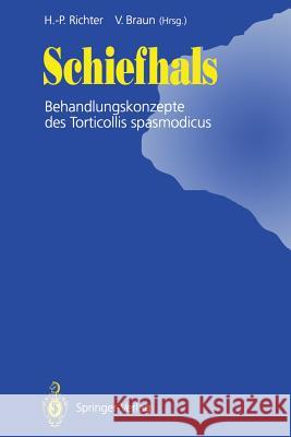 Schiefhals: Behandlungskonzepte Des Torticollis Spasmodicus Richter, Hans-Peter 9783642770654 Springer