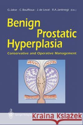 Benign Prostatic Hyperplasia: Conservative and Operative Management Jakse, Gerhard 9783642774829 Springer