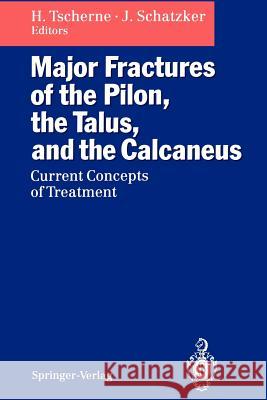 Major Fractures of the Pilon, the Talus, and the Calcaneus: Current Concepts of Treatment Tscherne, Harald 9783642777318