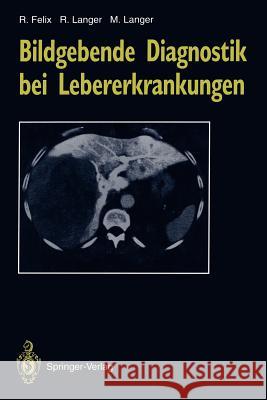 Bildgebende Diagnostik Bei Lebererkrankungen Felix, Roland 9783642777844 Springer