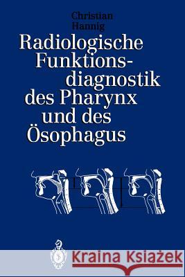 Radiologische Funktionsdiagnostik Des Pharynx Und Des Ösophagus Hannig, Christian 9783642781445 Springer