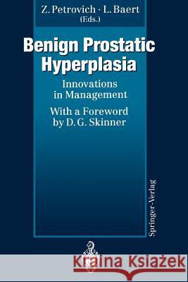 Benign Prostatic Hyperplasia: Innovations in Management Petrovich, Zbigniew 9783642781872 Springer