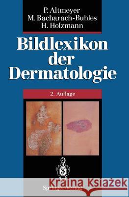 Bildlexikon Der Dermatologie Hans Holzmann                            N. Buhles Martina Bacharach-Buhles 9783642785481 Springer