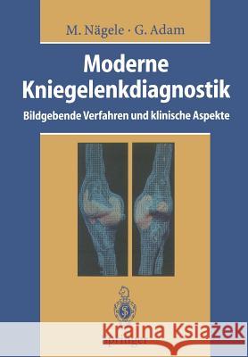 Moderne Kniegelenkdiagnostik: Bildgebende Verfahren Und Klinische Aspekte Günther, R. W. 9783642786280 Springer