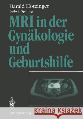 MRI in Der Gynäkologie Und Geburtshilfe Hamm, B. 9783642789502 Springer