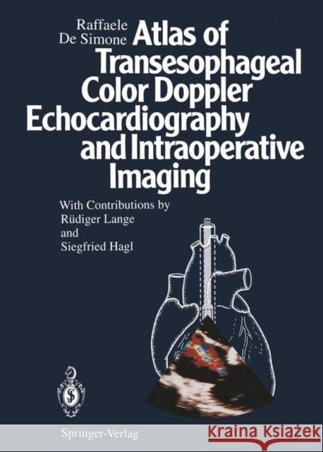 Atlas of Transesophageal Color Doppler Echocardiography and Intraoperative Imaging Lange, R. 9783642789588 Springer