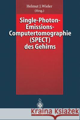 Single-Photon-Emissions-Computertomographie (Spect) Des Gehirns Wieler, Helmut J. 9783642792236 Springer