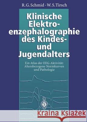 Klinische Elektroenzephalographie Des Kindes- Und Jugendalters: Ein Atlas Der Eeg-Aktivität: Altersbezogene Normkurven Und Pathologie Kugler, J. 9783642793059 Springer