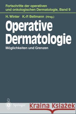 Operative Dermatologie: Möglichkeiten Und Grenzen Winter, Helmut 9783642794698