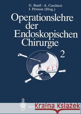 Operationslehre Der Endoskopischen Chirurgie: Band 2 Bueß, Gerhard F. 9783642797347 Springer