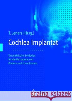 Cochlea-Implantat: Ein Praktischer Leitfaden Für Die Versorgung Von Kindern Und Erwachsenen Lenarz, Thomas 9783642800054 Springer