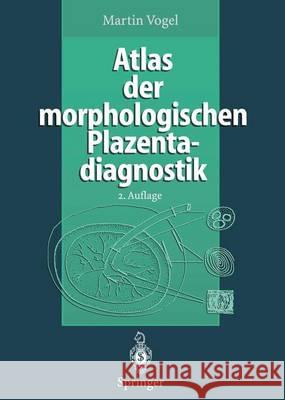 Atlas Der Morphologischen Plazentadiagnostik Vogel, Martin 9783642800849