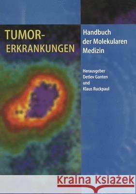 Tumorerkrankungen Detlev Ganten Klaus Ruckpaul 9783642803635