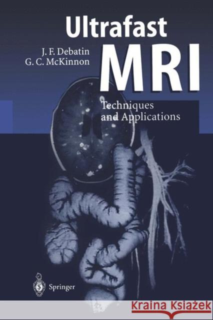 Ultrafast MRI: Techniques and Applications Debatin, Jörg F. 9783642803864 Springer