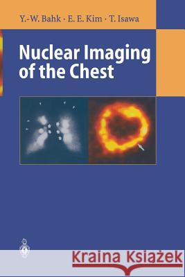 Nuclear Imaging of the Chest Yong-Whee Bahk E. Edmund Kim Toyoharu Isawa 9783642803895