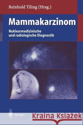 Mammakarzinom: Nuklearmedizinische Und Radiologische Diagnostik Lissner, J. 9783642804397 Springer