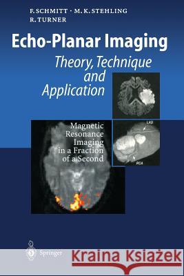 Echo-Planar Imaging: Theory, Technique and Application Schmitt, Franz 9783642804458 Springer