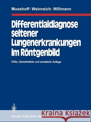 Differentialdiagnose Seltener Lungenerkrankungen Im Röntgenbild Musshoff, K. 9783642813245 Springer