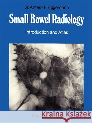 Small Bowel Radiology: Introduction and Atlas Antes, Günther 9783642824753