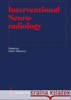 Interventional Neuroradiology Anton Valavanis M. W. Donner F. Heuck 9783642844362 Springer