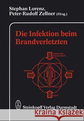 Die Infektion Beim Brandverletzten Lorenz, S. 9783642854200 Steinkopff-Verlag Darmstadt