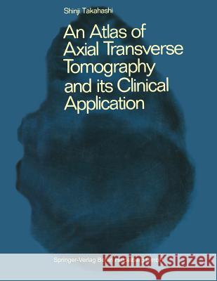 An Atlas of Axial Transverse Tomography and Its Clinical Application Takahashi, A. S. 9783642855658 Springer