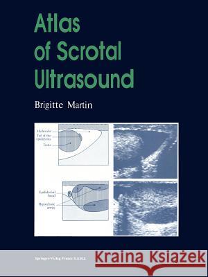 Atlas of Scrotal Ultrasound Brigitte Martin M. Donon H. Hricak 9783642856839 Springer