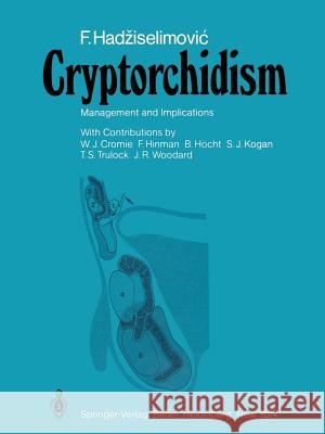 Cryptorchidism: Management and Implications Hadziselimovic, F. 9783642860225 Springer