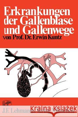 Erkrankungen Der Gallenblase Und Gallenwege Kuntz, E. 9783642866371 Springer
