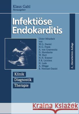 Infektiöse Endokarditis: Klinik Diagnostik Therapie Daniel, W. G. 9783642870804 Steinkopff-Verlag Darmstadt