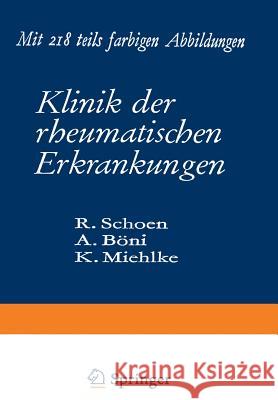 Klinik Der Rheumatischen Erkrankungen Schoen, Rudolf 9783642871740 Springer
