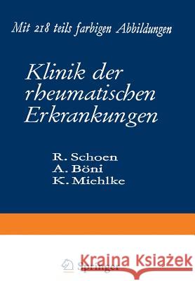 Klinik Der Rheumatischen Erkrankungen Schoen, Rudolf 9783642871740