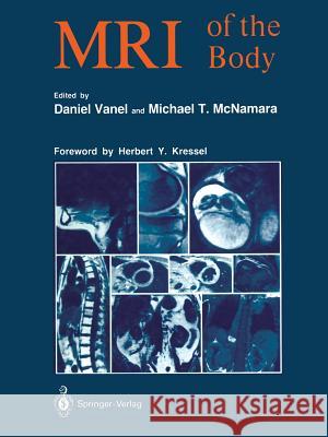 MRI of the Body Daniel Vanel Michael T. McNamara Susanne Assenat 9783642875588