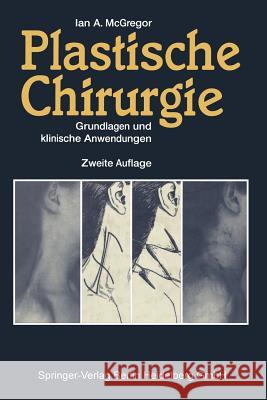 Plastische Chirurgie: Grundlagen Und Klinische Anwendungen Biemer, E. 9783642878794 Springer