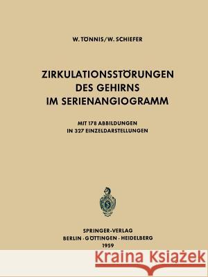 Zirkulationsstörungen Des Gehirns Im Serienangiogramm Tönnis, W. 9783642887352 Springer