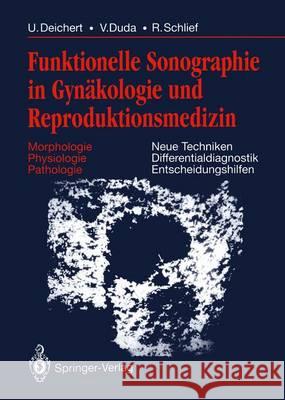 Funktionelle Sonographie in Gynäkologie Und Reproduktionsmedizin: Morphologie Physiologie Pathologie Neue Techniken Differentialdiagnostik Entscheidun Bartels, H. 9783642934780 Springer