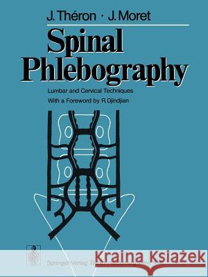 Spinal Phlebography: Lumbar and Cervical Techniques Theron, J. 9783642953262 Springer