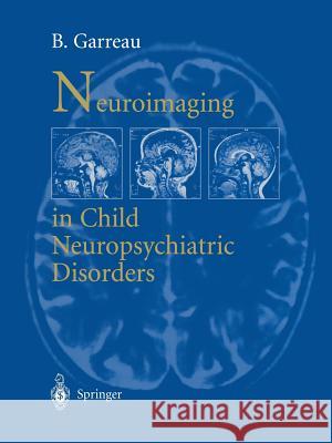 Neuroimaging in Child Neuropsychiatric Disorders Garreau, B. 9783642958502 Springer