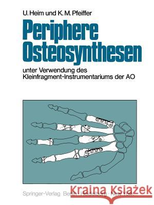 Periphere Osteosynthesen: Unter Verwendung Des Kleinfragment-Instrumentariums Der Ao Meuli, H. C. 9783642961250 Springer