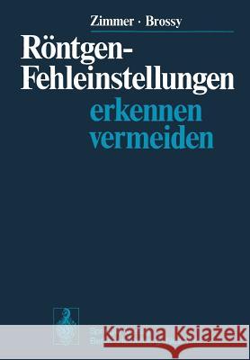 Röntgen-Fehleinstellungen: Erkennen Und Vermeiden Zimmer, E. a. 9783642962646 Springer