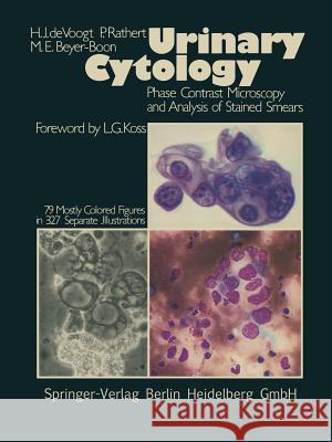 Urinary Cytology: Phase Contrast Microscopy and Analysis of Stained Smears Koss, L. G. 9783642963902 Springer