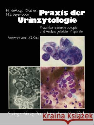 Praxis Der Urinzytologie: Phasenkontrastmikroskopie Und Analyse Gefärbter Präparate Koss, L. G. 9783642965180 Springer